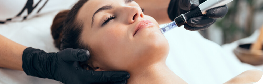 Microneedling